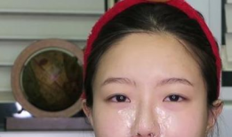 挤鼻子黑头视频,鼻子焕发光彩！